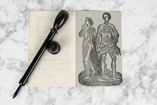 (QUACKERY). BAUNSCHEIDT, Carl. Le Baunscheidtisme.