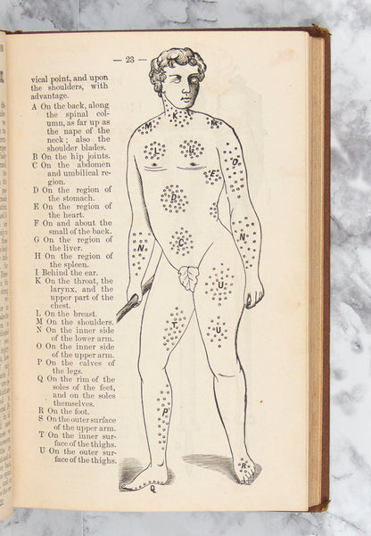 (QUACKERY). BAUNSCHEIDT, Carl. Le Baunscheidtisme.