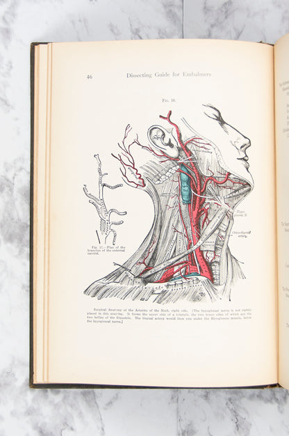 (MORTUARY SCIENCE). NUNNAMAKER, Albert John, and Charles O. DHONAU. Dissecting Guide for Embalmers.